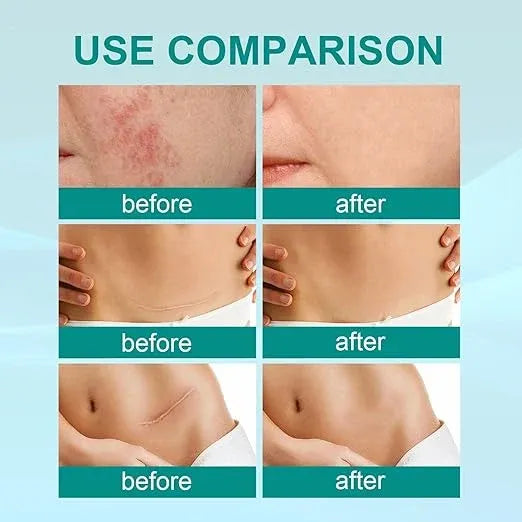 South Moon Scar Spray