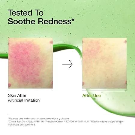 Anua Azelaic Acid 10 + Hyaluron Redness Soothing Serum