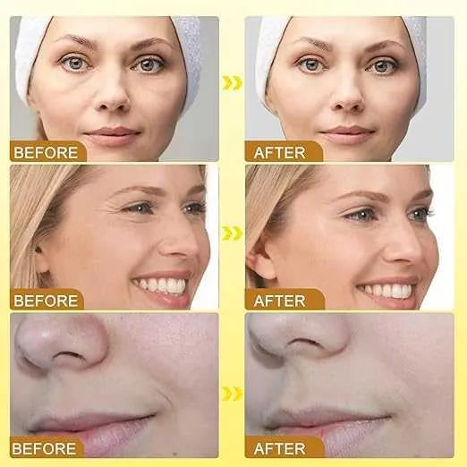 OUHOE - Bee Venom Botox Wrinkle Cream